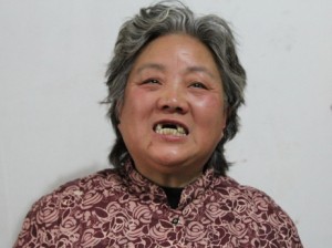 Shen Lixiu, 58, says she had her front teeth kicked out in a re-education through labor camp. She says authorities had her beaten so she would sign a compensation agreement for the government demolition of her karaoke parlor in Nanjing. (Frank Langfitt/NPR)