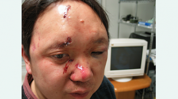 Dr. Peter Yuan Li hours after being bound and beaten in his Atlanta home by assailants who took only computers and documents, leaving other valuables untouched, in 2006. (Epoch Times)